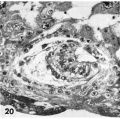 20 Detail embryo and surrounding trophoblast