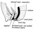 Fig. 97. Rectal part of the Anal Plate has persisted and the Cloacal Septum has failed to fuse with the Perineal Septum.