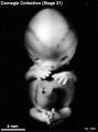 Embryo No. 7392 (front)