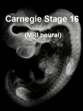 Stage16 MRI 3D02 icon.jpg