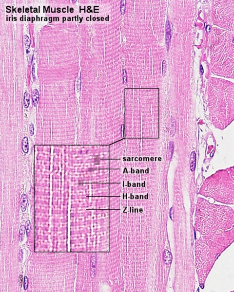 File:Skeletal muscle histology 013.jpg