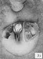 Fig. 35. No. 1597b, 44 mm., female (perineal view). X 4.