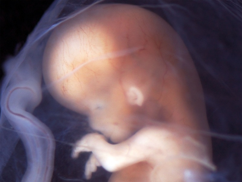 File:Human- fetal week 10 bf02.jpg
