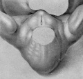 Fig. 6. No. 2023, 15 mm, female. X 14.