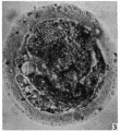 Fig. 3. Ovum no. 2 sperm in the zona pellucida