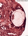 Embryo No.7700