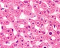 Hepatocytes (unlabel)