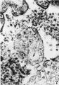 Fig 7 Cytotrophoblastic cell mitosis
