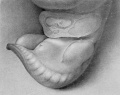 Fig. 1. Carnegie Embryo No. 467, 9 mm X 21.