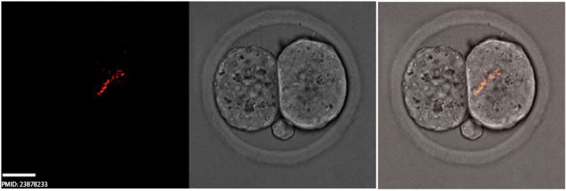 Spermatozoa mitochondria 2cell.jpg