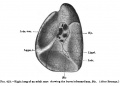Fig. 423. Right lung of an adult man showing the bursa infracardia
