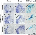 Mouse otic placode Spry1, Spry2, and Wnt