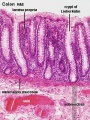 Colon Mucosa Labeled