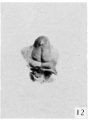 Fig. 12. Carnegie Embryo No. 1750, female