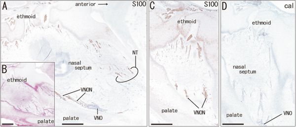 Human 15 weeks - terminal nerve and vomeronasal organ nerves
