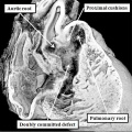 fig 46b Mouse E14.5 abnormal heart