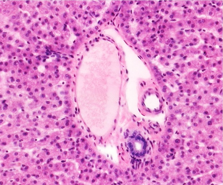 File:Liver histology 104.jpg