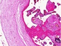 Placenta histology 008.jpg