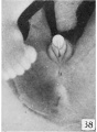 Fig. 38. No. 1625b, 54 mm., female. X 4.