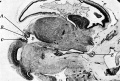 Fig. 2. Sagittal section through head of 35 mm embryo
