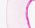Placenta histology 002.jpg