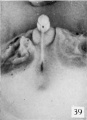 Fig. 39. No. 1183, 60 mm., male (perineal v-iew). X 4.