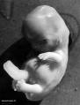 Homo32 embryo