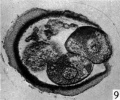 Figs. 9, 10. Two consecutive sections through the four-cell ovum shown in fig. 8. x 520.