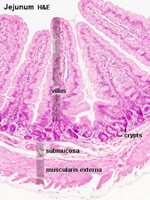 Intestine histology 004.jpg