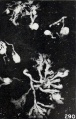Fig. 290. A group of teased villi bearing numerous trophoblastic nodules. No. 2225. X4.8.