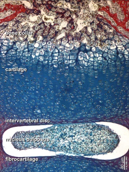 File:Ossification endochondral 1.jpg