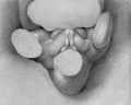 Fig. 4. Carnegie Embryo 1784a. 12 mm X 21.