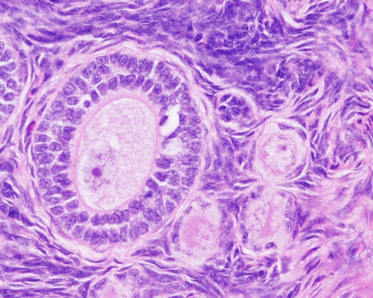 File:Ovary histology 005.jpg