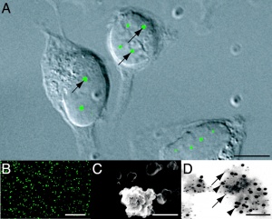 Nucleus Cajal bodies image