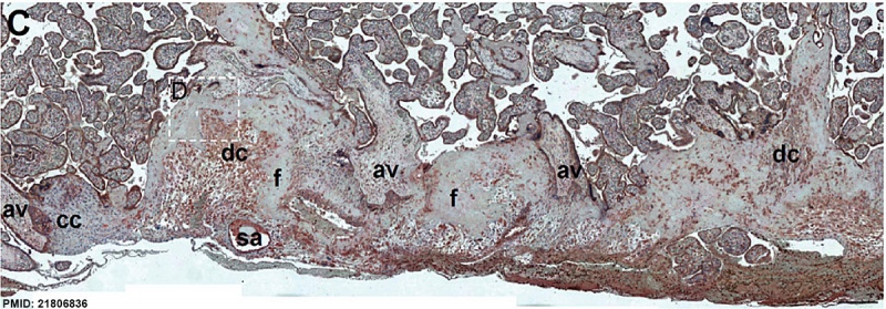 File:Human placenta SERPINE2 expression 02.jpg