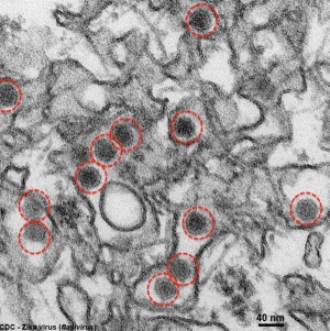 Zika virus TEM02.jpg