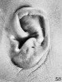 Fig. 58. Embryo No. 1708, 154 mm.