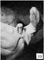 Fig. 20. Carnegie Embryo No.1900-60a.