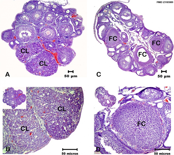 File:Mouse ovary normal and polycystic ovary syndrome 01.jpg
