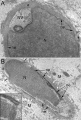 Human spermatid electron micrograph PMID 17012309