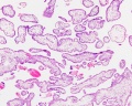Placental villi cross-section