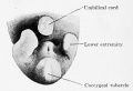 Fig. 607. Human embryo 18 mm Between the umbilicus and the coccygeal tubercle cranio-caudally and the two lower extremities laterally, the cloacal tubercle has appeared.