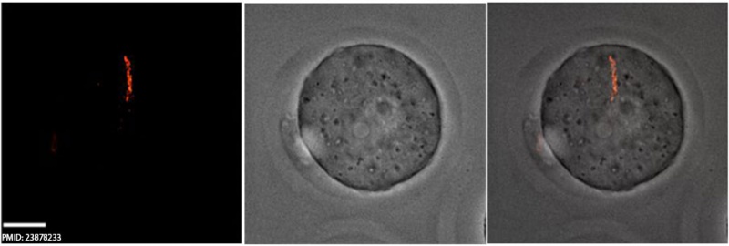 Spermatozoa mitochondria 1cell.jpg
