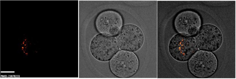Spermatozoa mitochondria 4cell.jpg