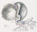 2 Human embryo 1.7 mm
