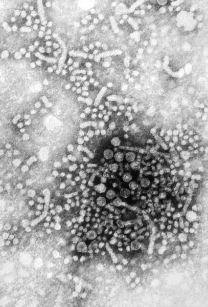 File:Hepatitis B virus.jpg