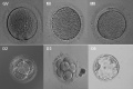 Human oocyte to blastocyst PMID 19924284