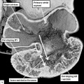 fig 8a Mouse E10.5 heart atrioventricular canal (EFIC)