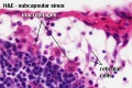 Subcapsular Sinus (marginal sinus, continuation of trabecular sinus)