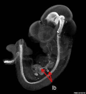 Mouse embryo E11 HNF3beta notochord marker 03.jpg